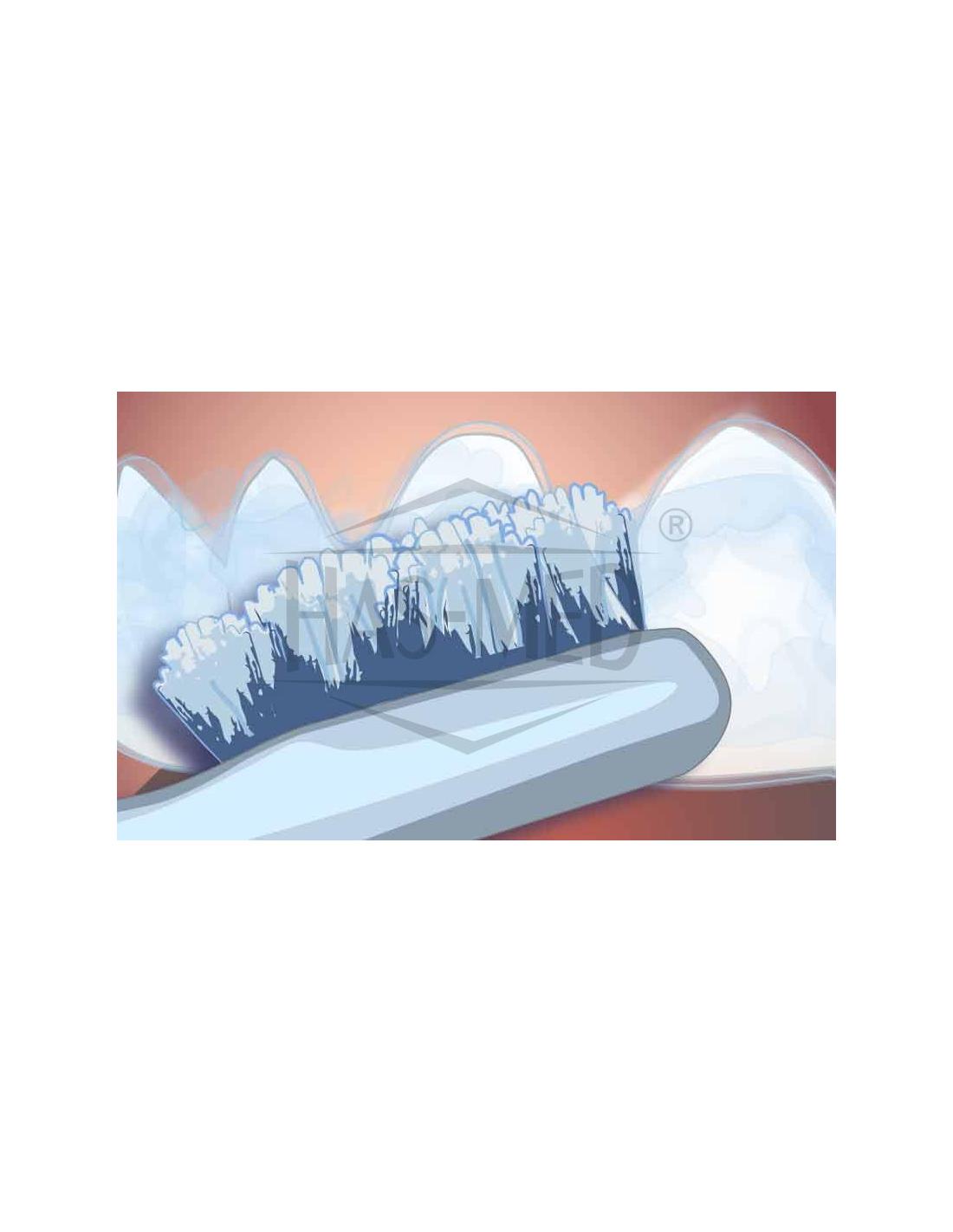 Opalescence PF 10% Żel do wybielania zębów