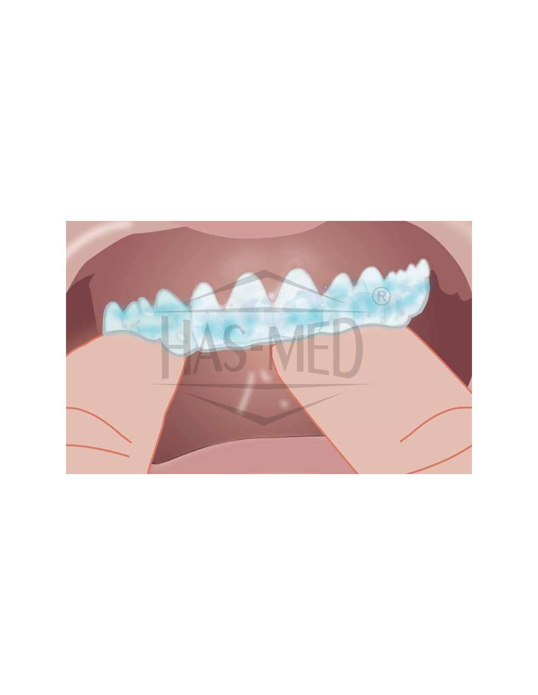 Opalescence PF 10% Żel do wybielania zębów